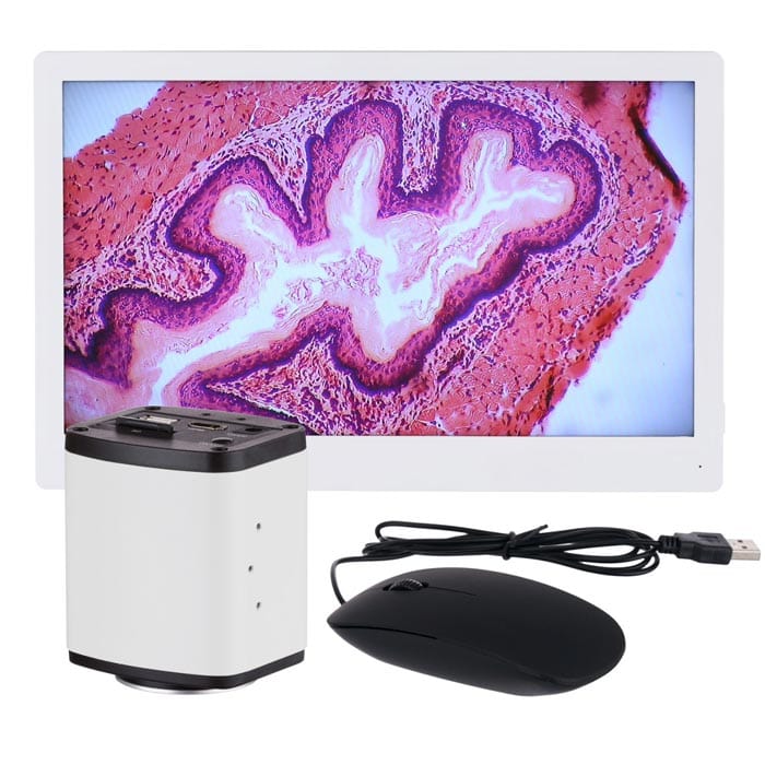AmScope 1080p Full HD HDMI Microscope Camera System with 11.5 Inch HD ...